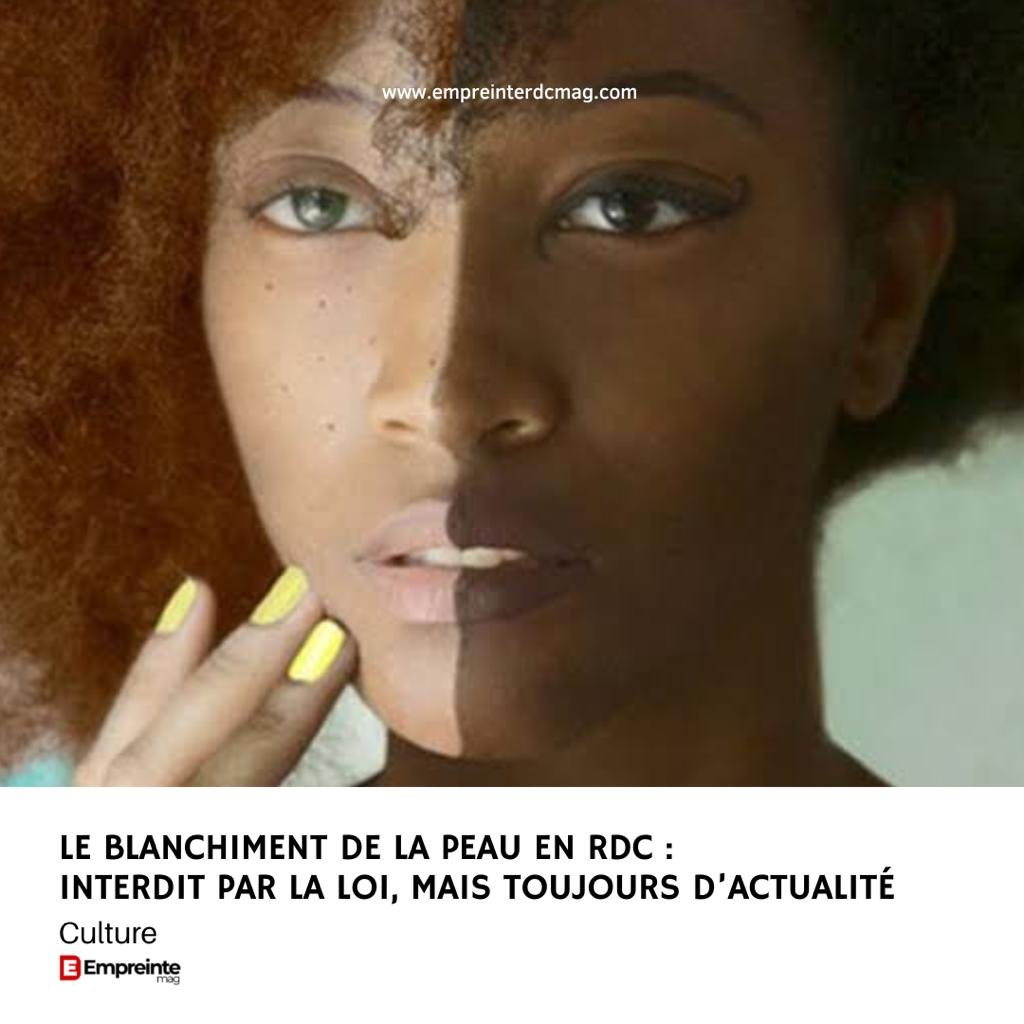 Crème Satin Skinz Hithion Plus Pour Blanchiment De La Peau 15 Ans+ - Soin Taches, Acné - Taille Voyage